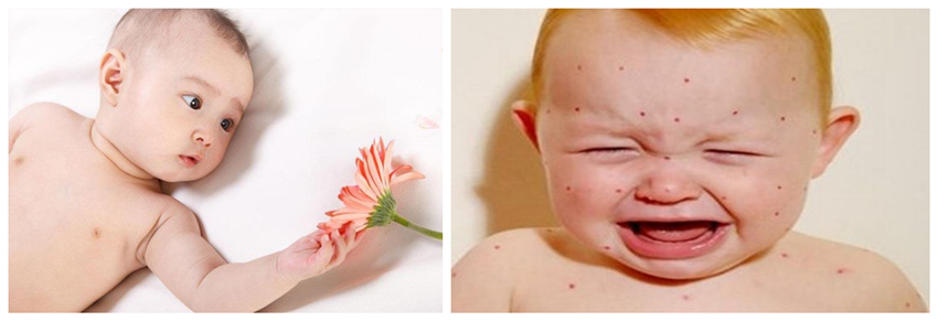 儿童湿疹反反复复，您有在家安装家用除湿产品吗？